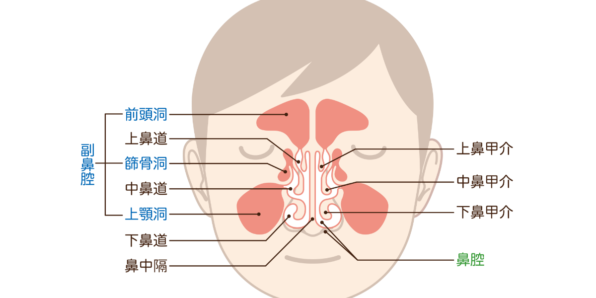 花粉症で頭痛が起きるのはなぜ?