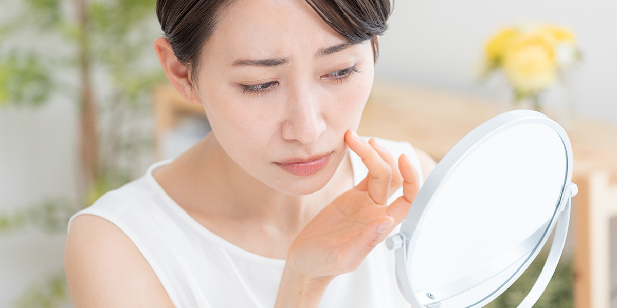 大人ニキビとは
